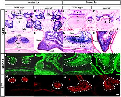 Hoxa2 Inhibits Bone Morphogenetic Protein Signaling during Osteogenic Differentiation of the Palatal Mesenchyme